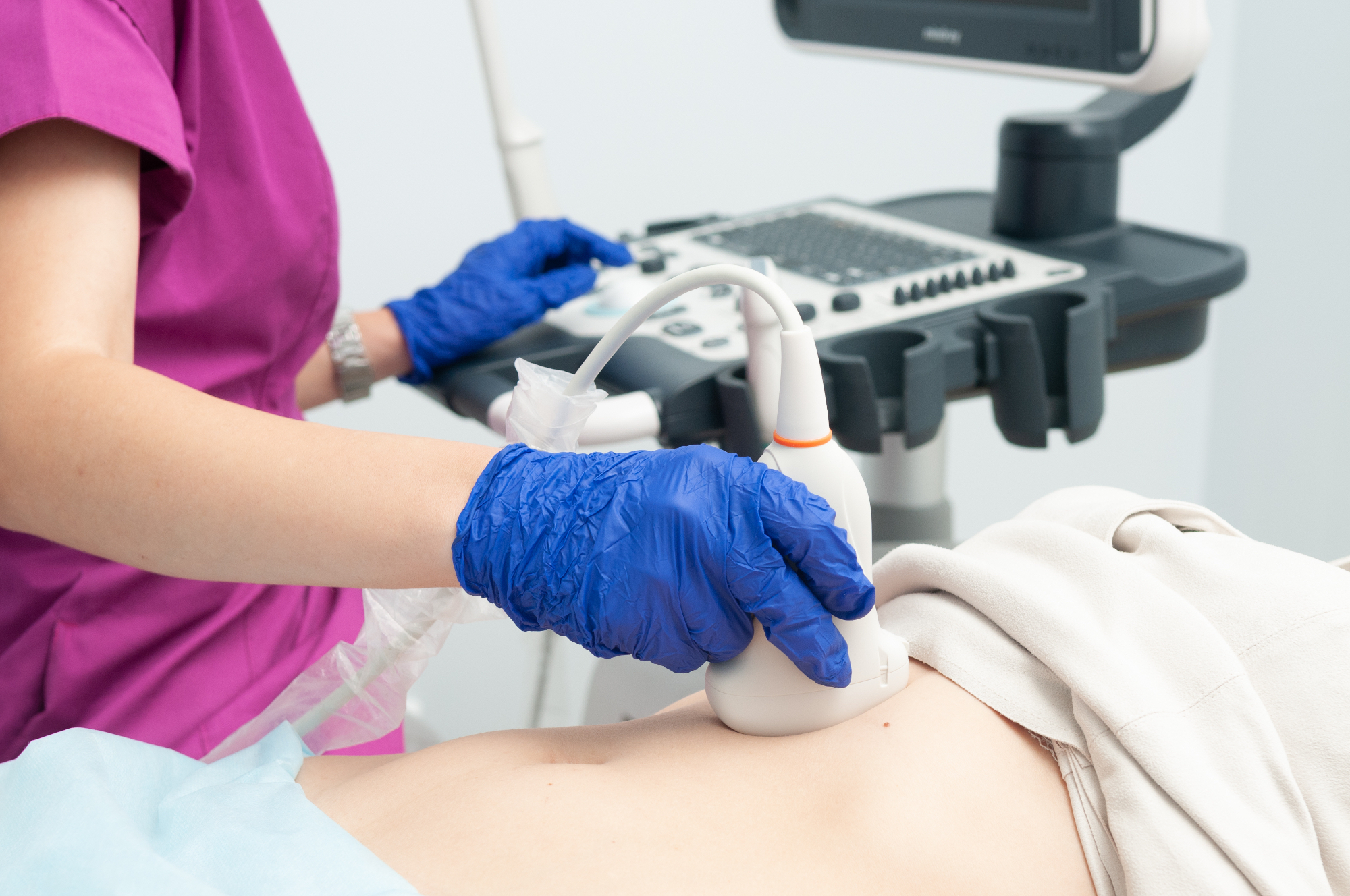 Hude bolečine in ultrazvok trebuha